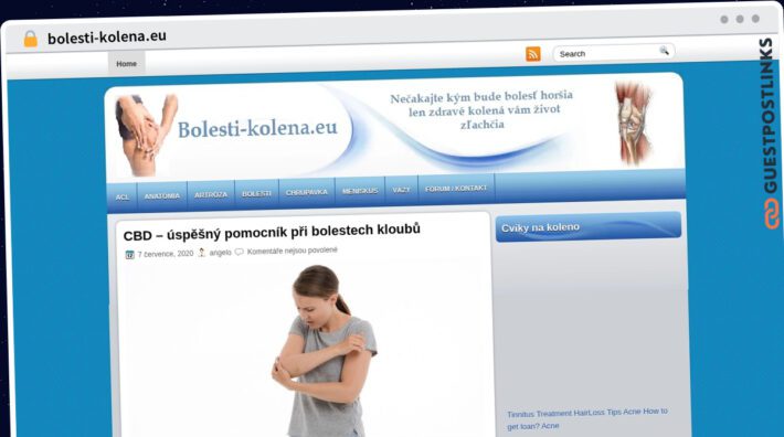 Publish Guest Post on bolesti-kolena.eu